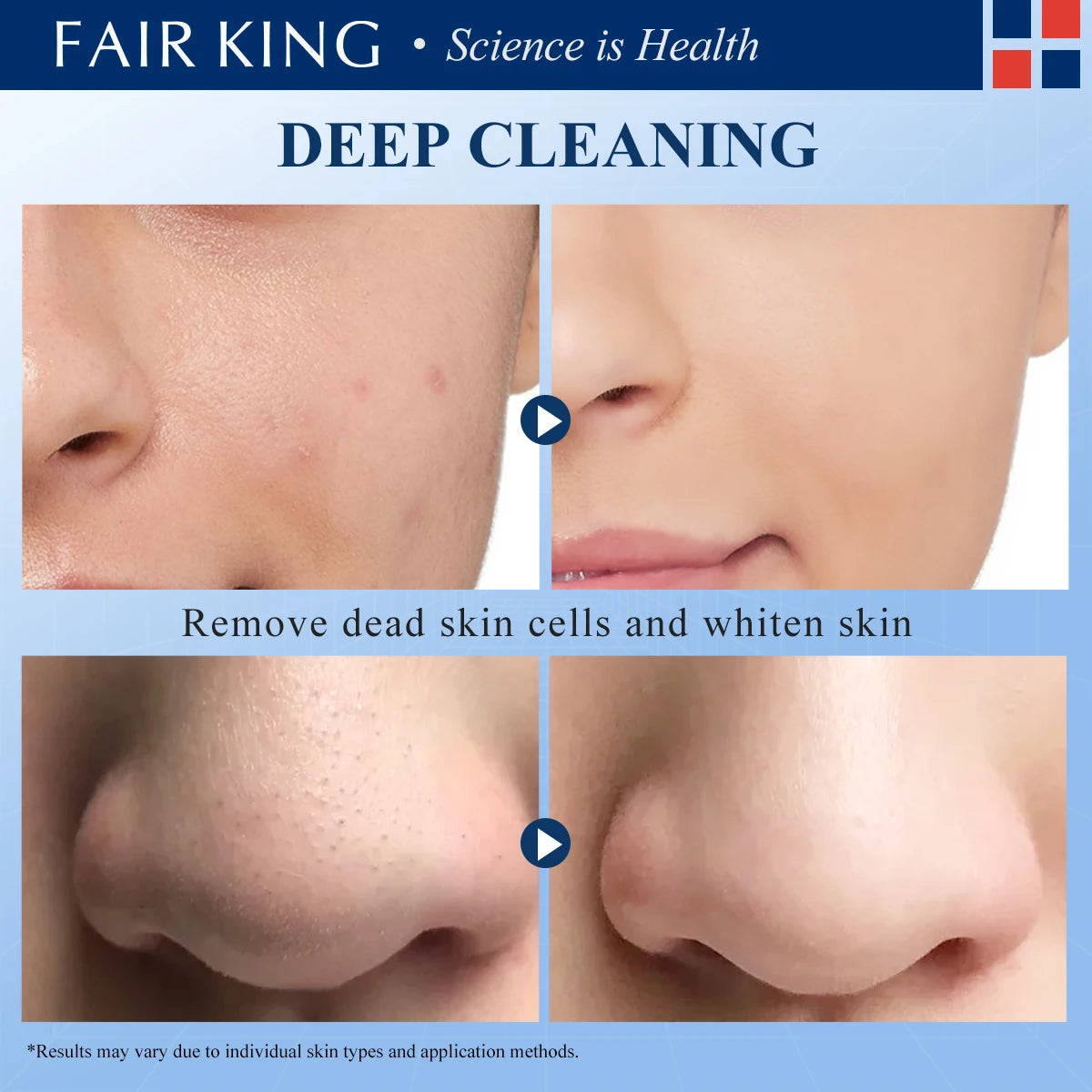 Green Tea Whitehead Oil Control Mask Deep Pore Cleansing Dirt Removes Whiteheads Skin Care Smooth Skin Whitening Moisturizing