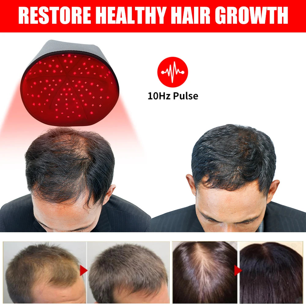 Red Light Therapy Cap for Hair Regrowth / Rejuvenation, 660nm 830nm Infrared Light Hair Thicken Device