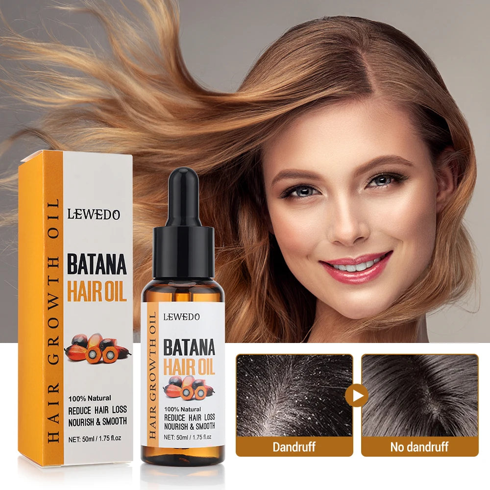 Anti-Hair Loss Batana Oil Natural Hair Conditioner Hair Growth Products Strengthen Roots Anti-Breakage Treatment US Warehouse